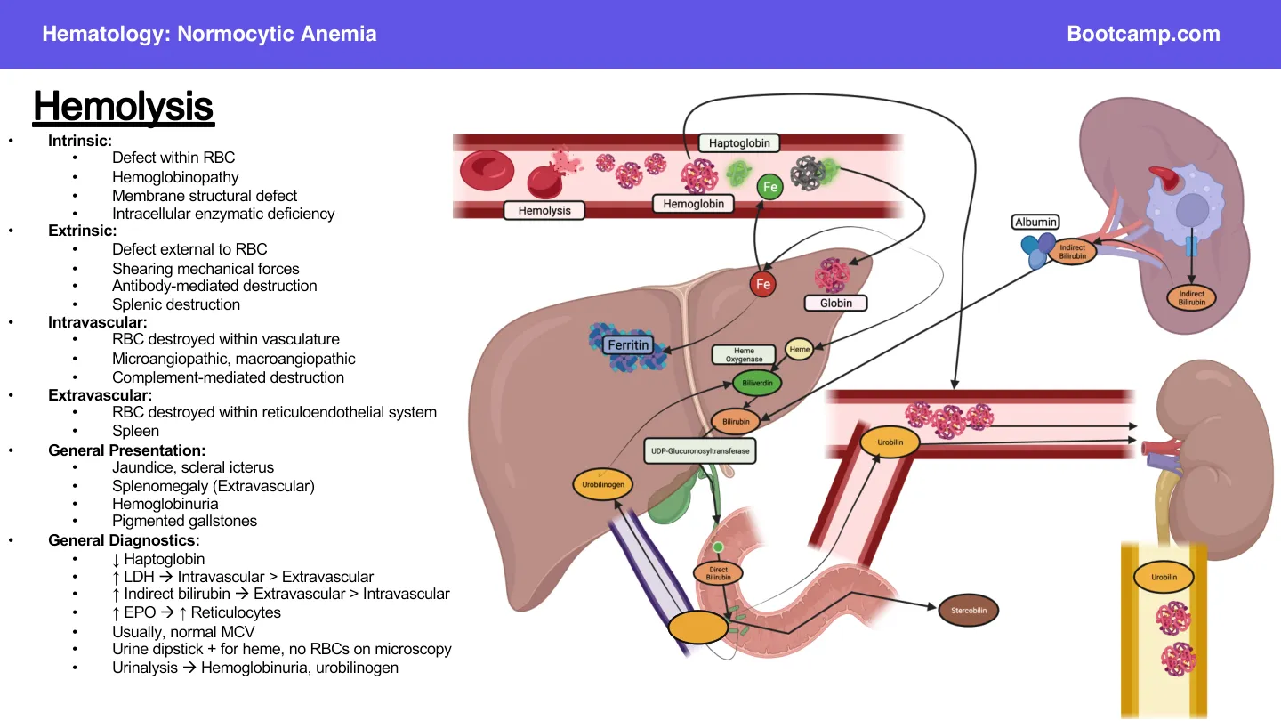 Bootcamp: haemolysis — splenic destruction, bilirubin, jaundice and scleral icterus