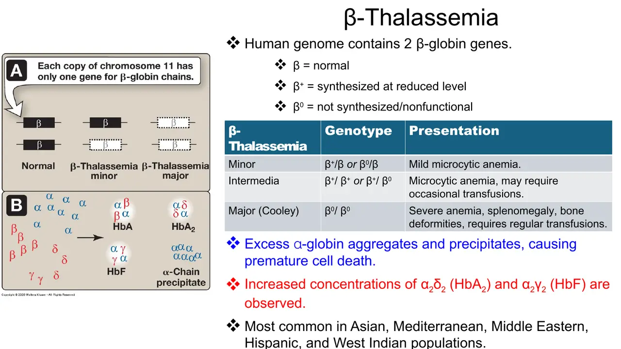 Lecture: β, β+, β0 alleles; excess α precipitates; ↑HbA2, ↑HbF; genotype table