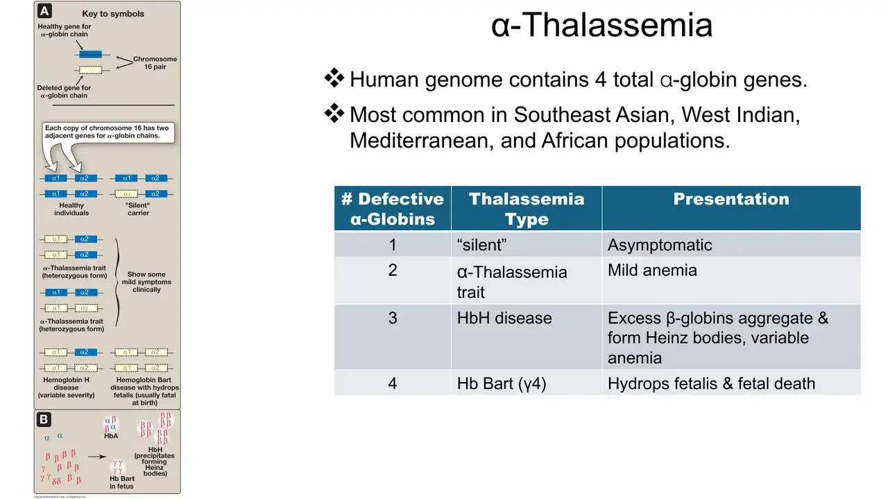 Lecture: 4 α genes; table of 1–4 defective genes and presentations
