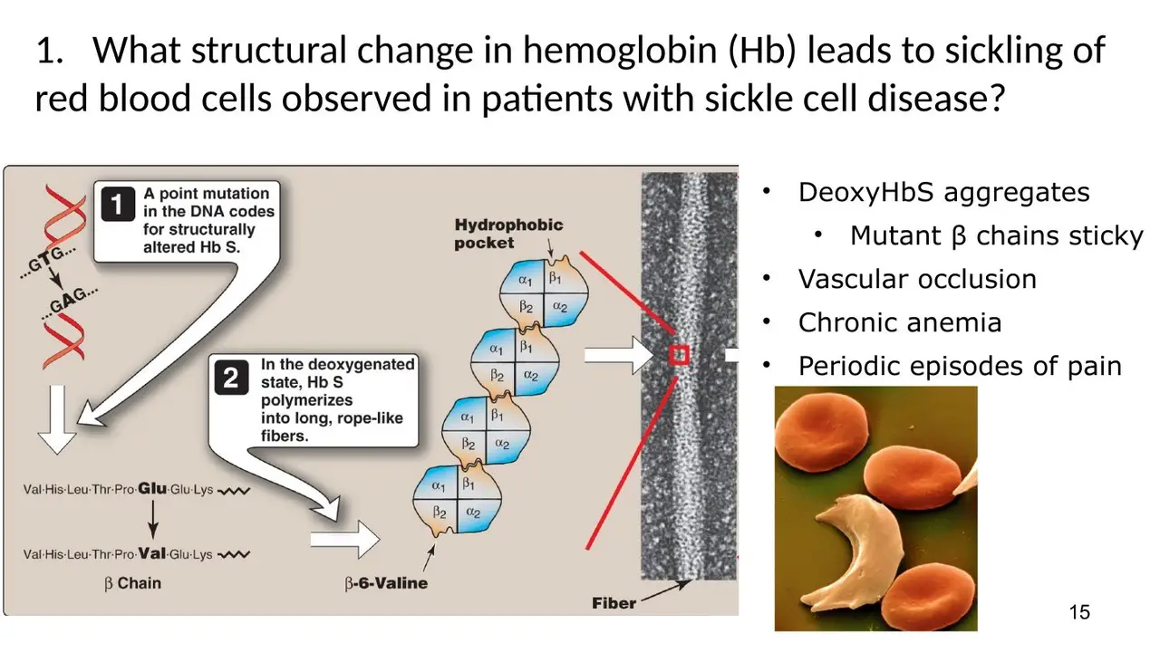 Case session: point mutation, deoxy-HbS polymerises into rope-like fibres, sickling