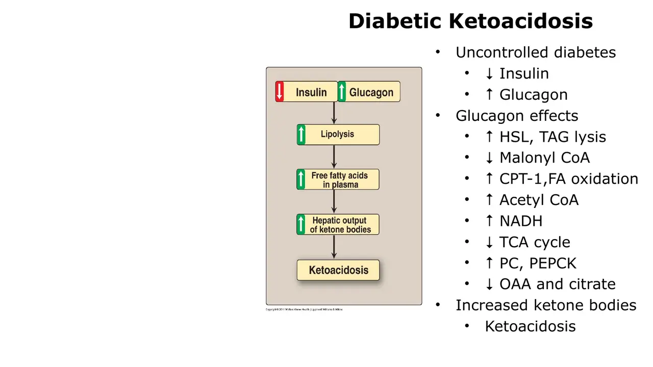 Lecture: DKA cascade from low insulin and high glucagon to ketoacidosis
