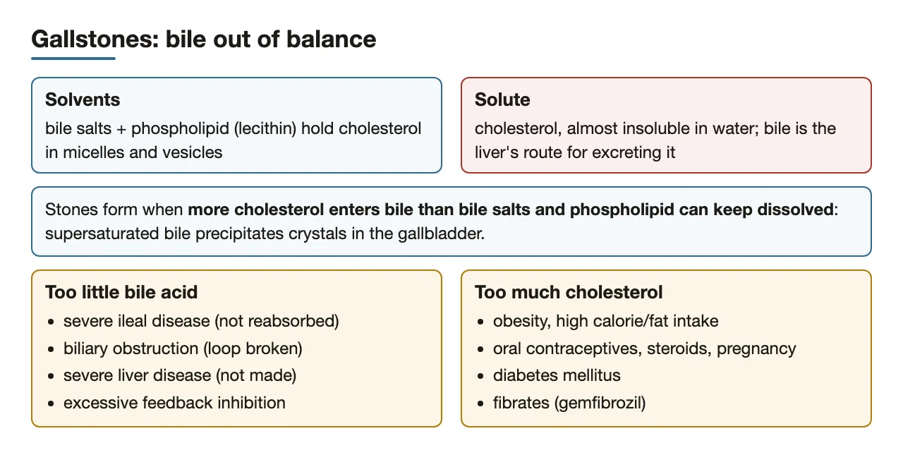 Stones form when cholesterol exceeds bile salt and phospholipid capacity