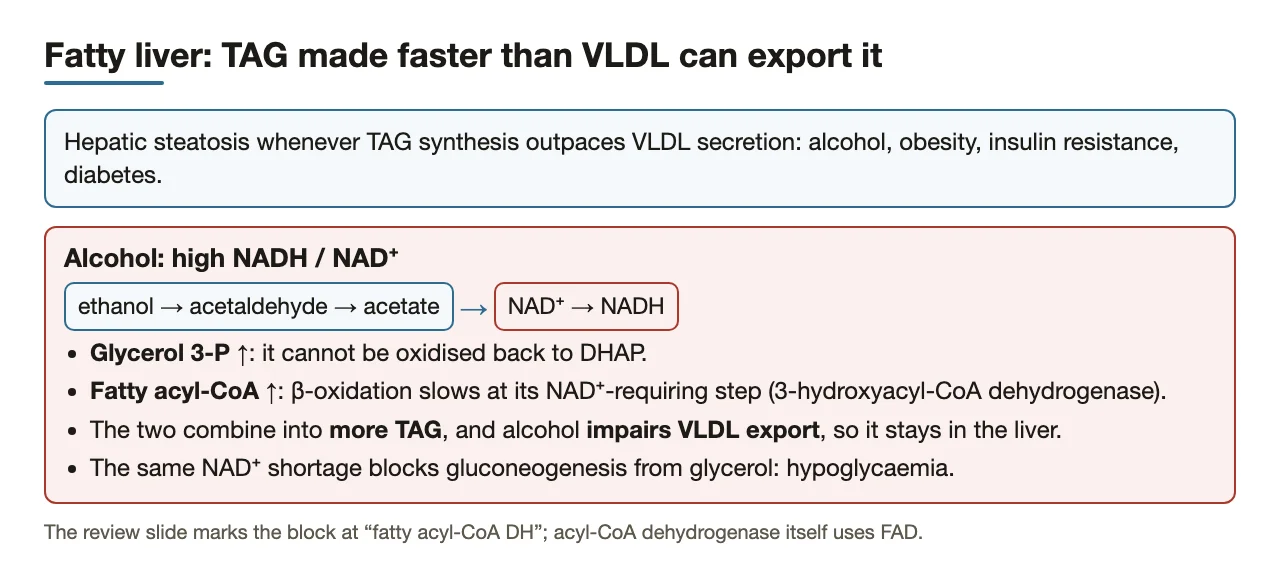 Fatty liver: TAG made faster than VLDL exports it; alcohol's excess NADH drives it.