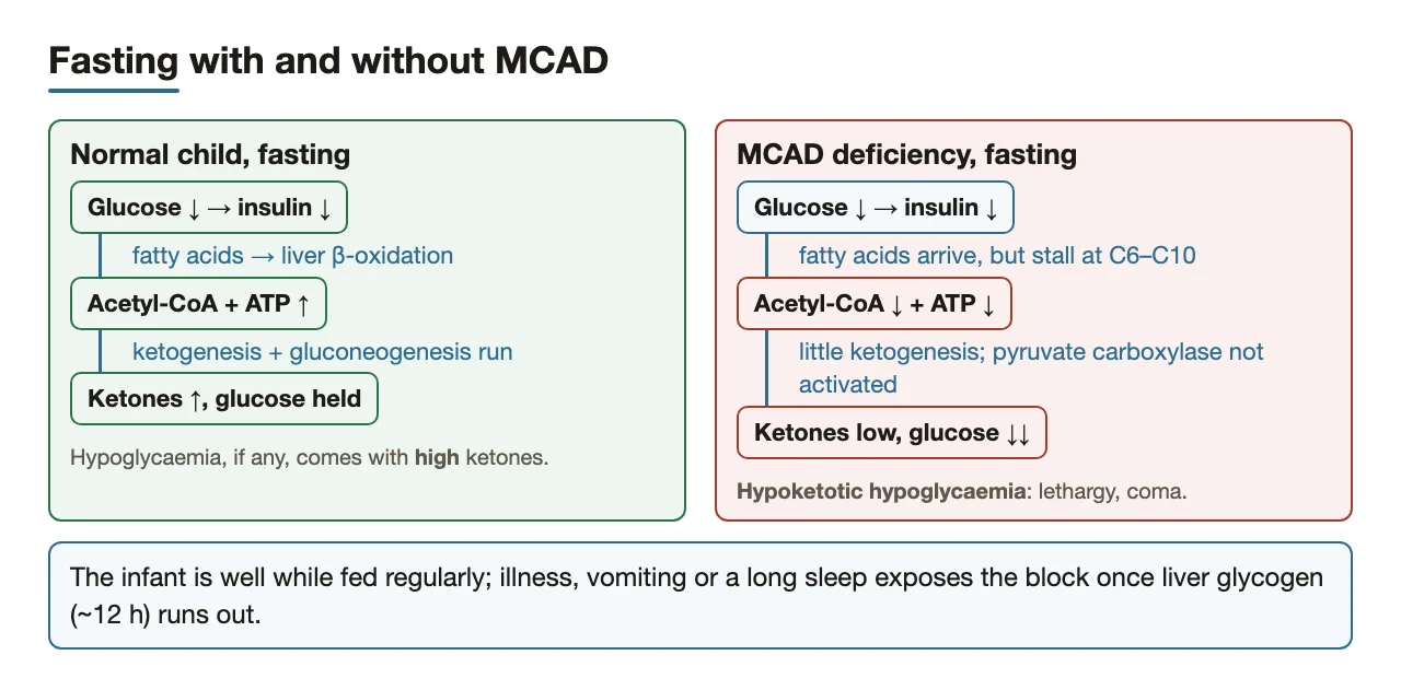 Fasting normally vs with MCAD deficiency: ketotic vs hypoketotic hypoglycaemia