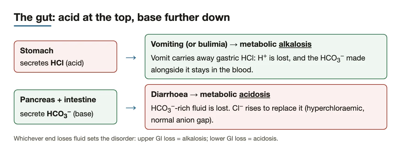 Vomiting loses HCl → alkalosis; diarrhoea loses HCO3− → acidosis.