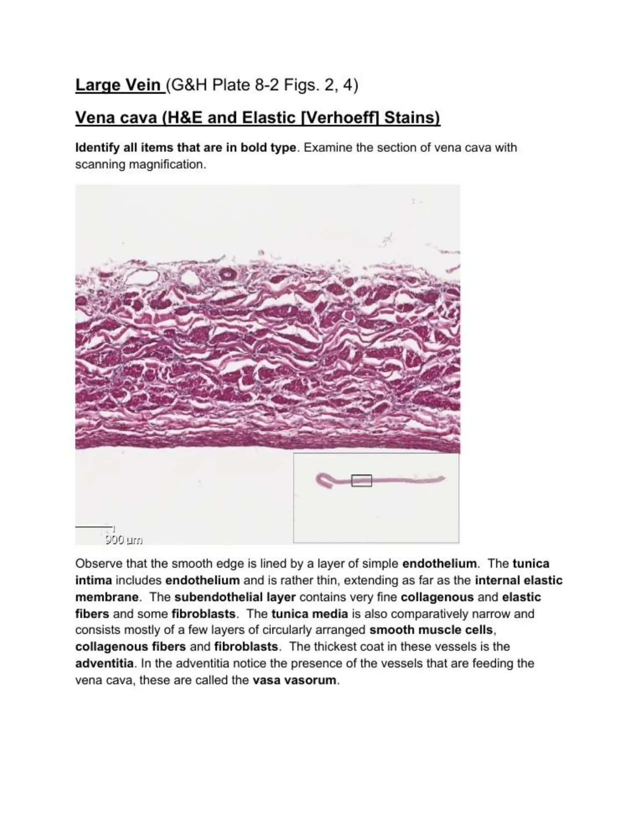 Lab manual vena cava: thin intima and media, thick adventitia with muscle bundles and vasa vasorum