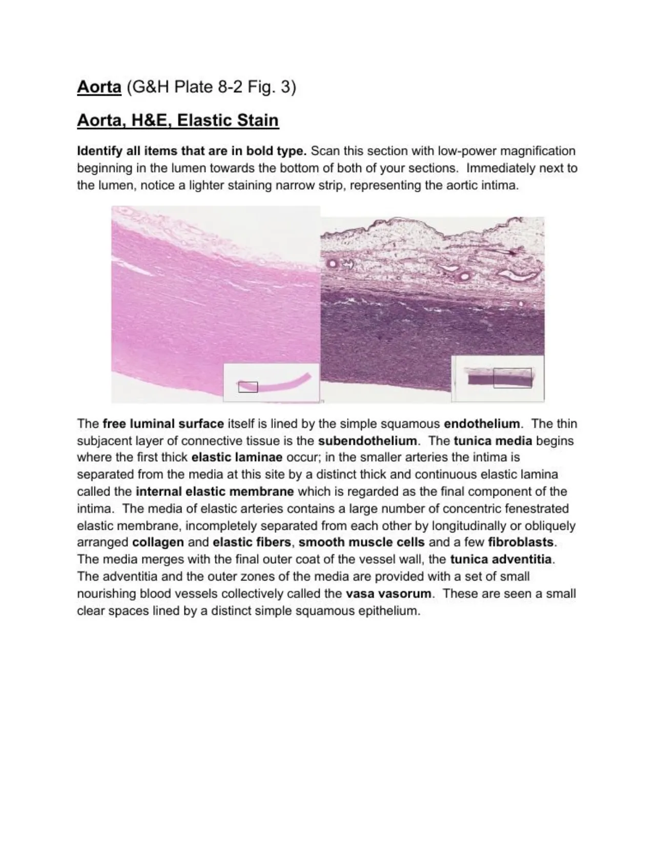 Lab manual aorta (H&E, elastic): thin intima, lamellar media, vasa vasorum in the adventitia