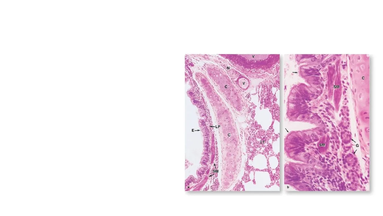 Vidal: intrapulmonary bronchus, smooth muscle (SM), glands (G), cartilage plates (C), lung tissue