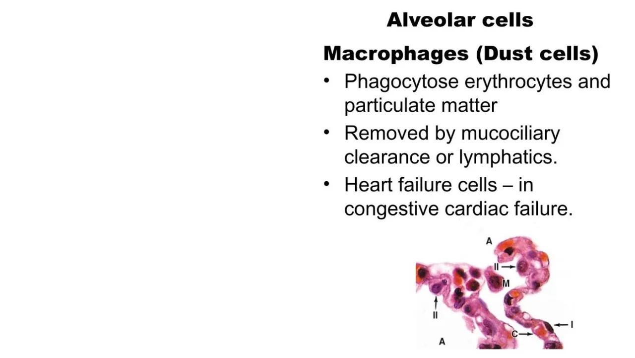 Vidal: dust cells phagocytose particles and are removed by mucociliary clearance or lymphatics