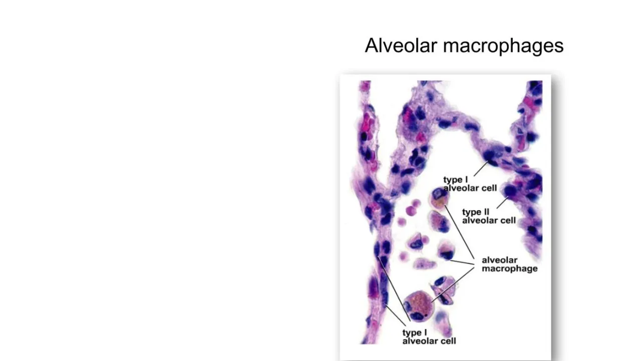 Lecture: labelled type I and type II alveolar cells and pigment-laden alveolar macrophages in the lumen