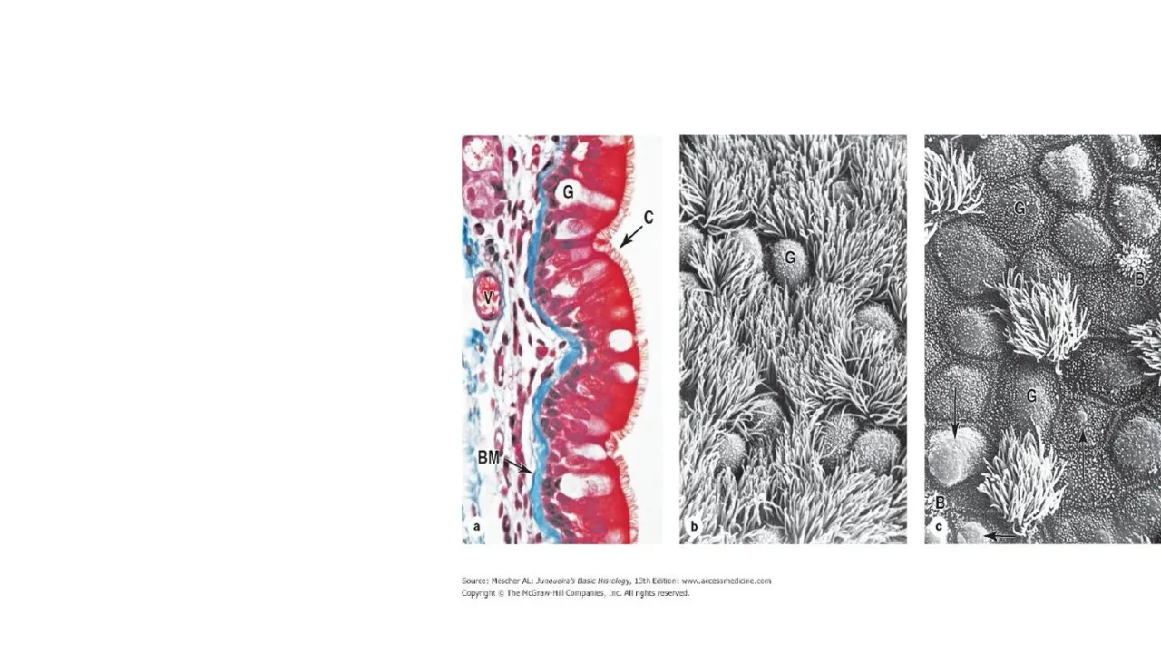 Vidal: respiratory epithelium in trichrome (cilia C, goblet G, thick BM) and SEM of the surface
