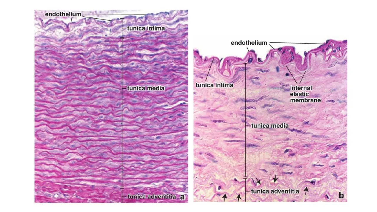 Elastic (a) vs muscular (b) artery walls with intima, media, adventitia and IEL labelled