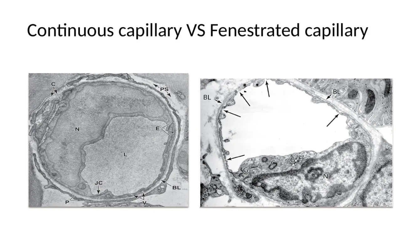 TEM: continuous capillary (junctions, vesicles, continuous BL) vs fenestrated capillary (arrows = pores)