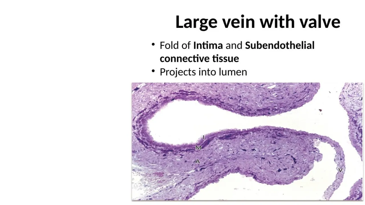 Lecture: large vein with valve, a fold of intima and subendothelial CT projecting into the lumen