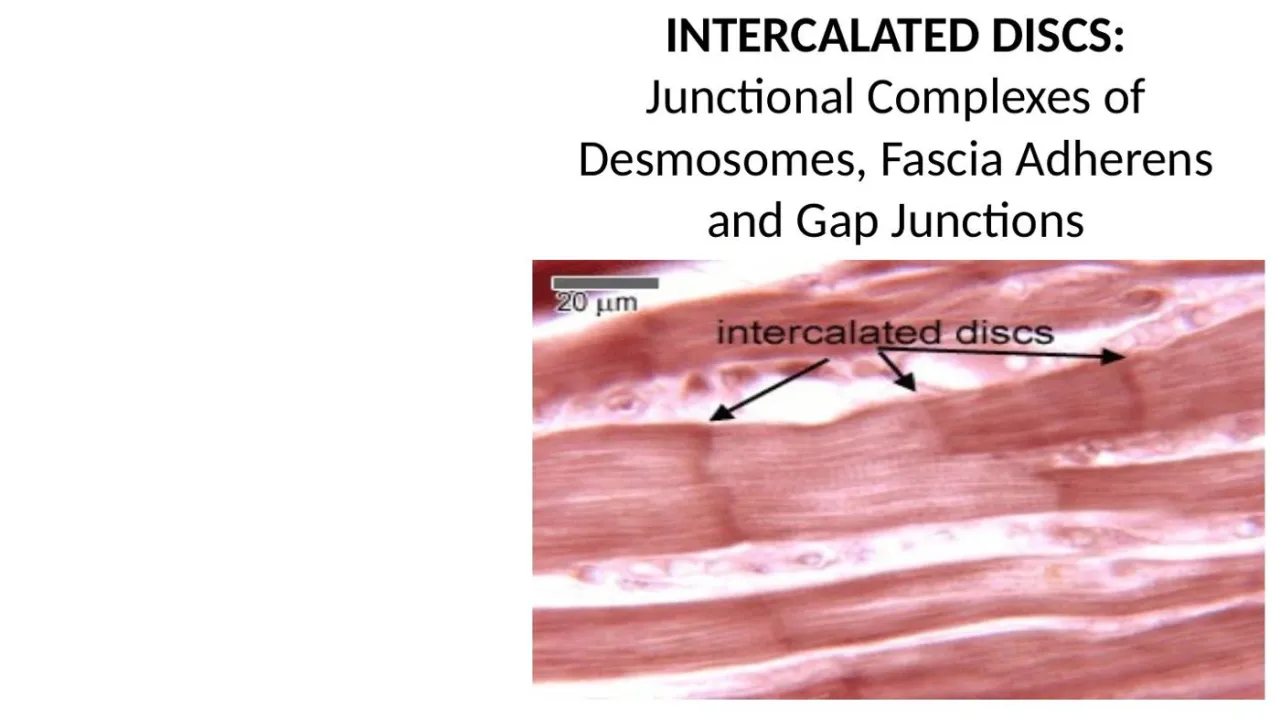 Lecture: intercalated discs as dark transverse lines between cardiac muscle cells