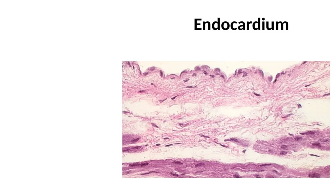 Lecture: endocardium micrograph, endothelium over loose CT with smooth muscle