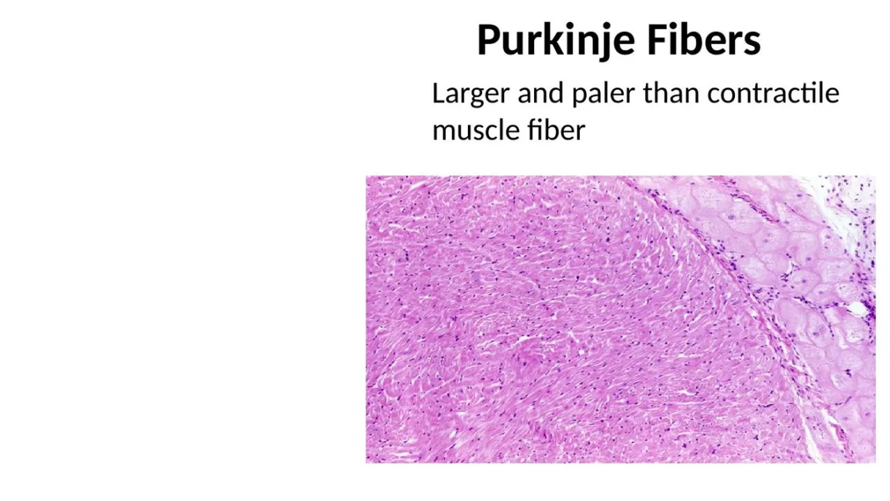 Lecture: Purkinje fibers are larger and paler than contractile muscle fibers