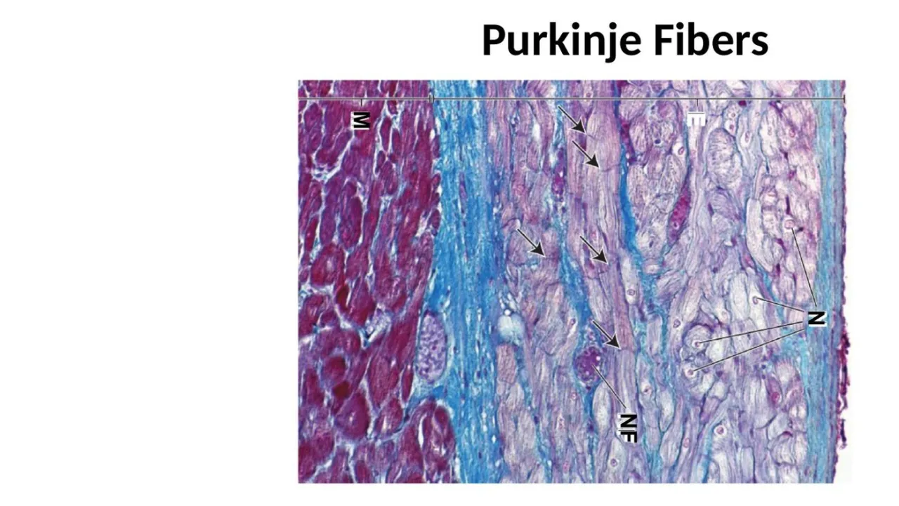 Lecture trichrome: Purkinje fibers with nerves (N, NF) in blue CT next to red myocardium (M)