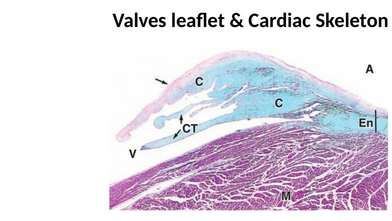 Lecture trichrome: valve cusp with blue dense CT core (C), chordae (CT), En and myocardium (M)