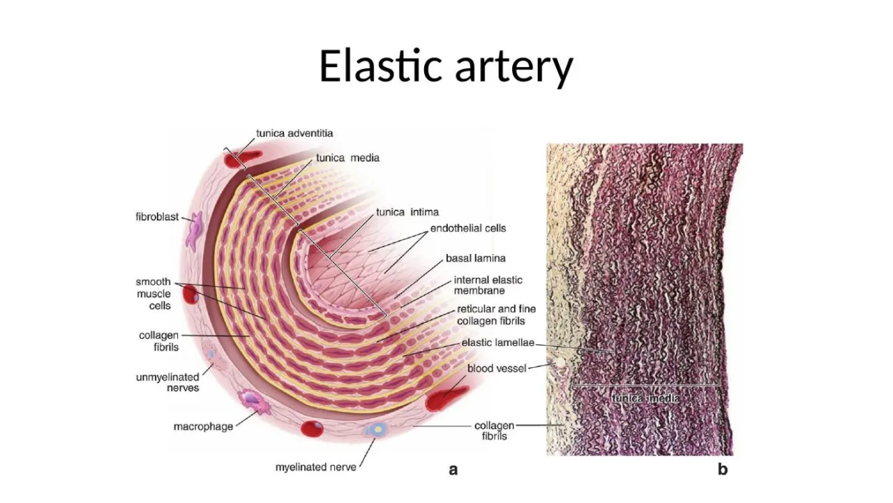 Elastic artery: diagram and elastic stain with dark wavy lamellae filling the media
