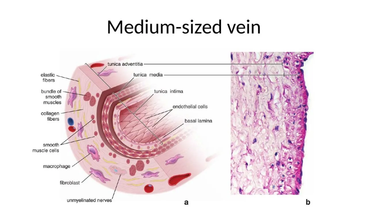 Medium-sized vein: diagram and micrograph with a thin media and thick collagenous adventitia