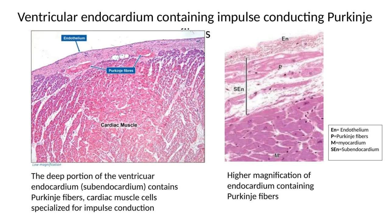 2026 lab: ventricular endocardium labelled En, SEn, P (Purkinje fibers) and M