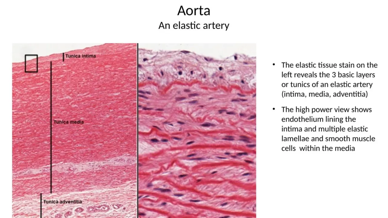 2026 lab aorta: elastic stain of intima, media, adventitia; high power of lamellae and SM cells