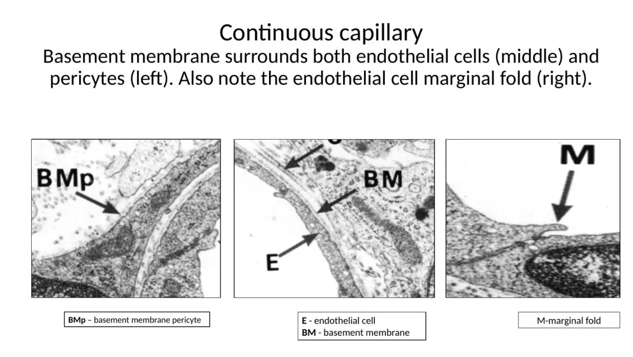 2026 lab TEM, continuous capillary: basement membrane around endothelium and pericyte; marginal fold (M)