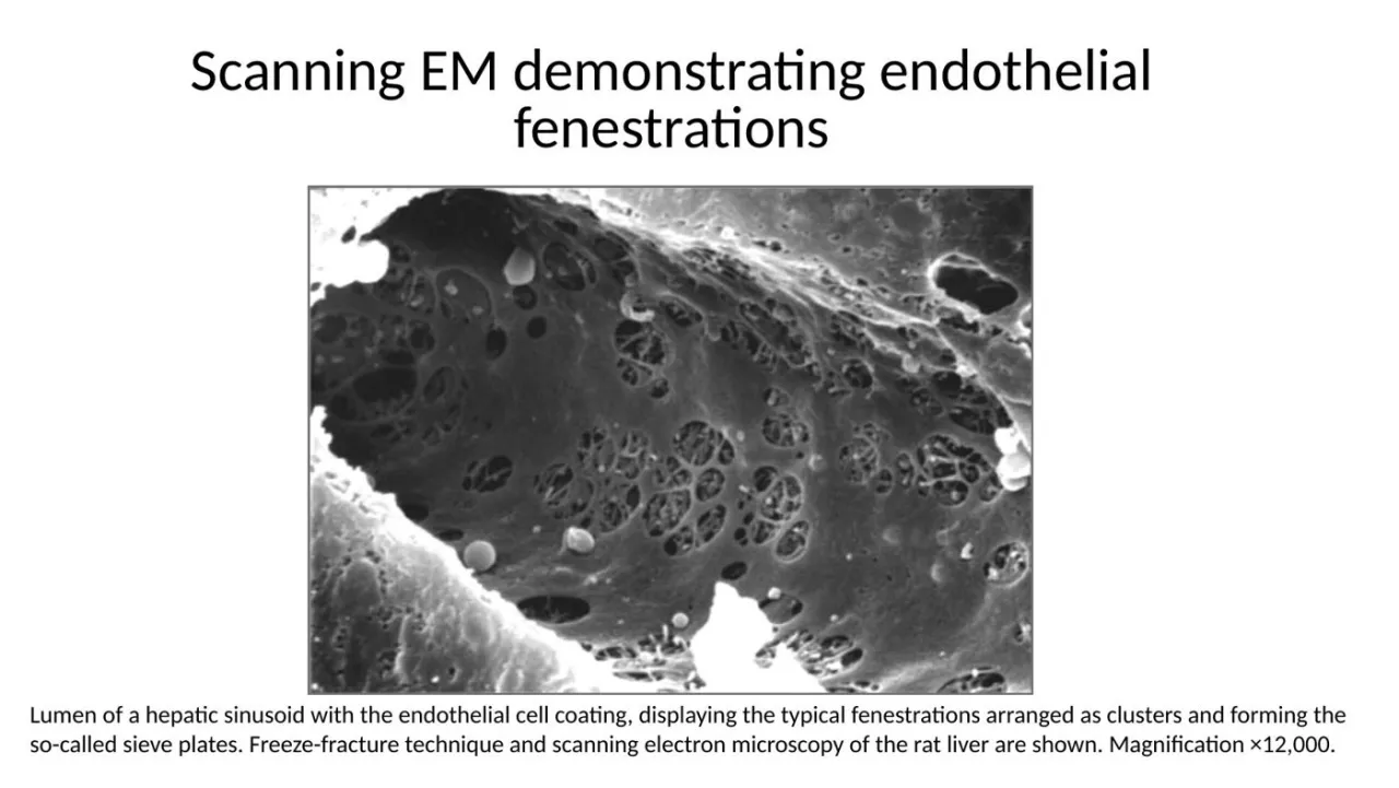 SEM of a liver sinusoid: endothelial fenestrae clustered into sieve plates