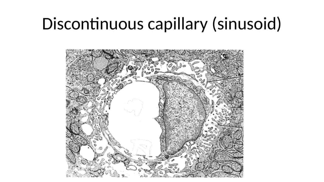 2026 lab TEM: discontinuous capillary (sinusoid), wide lumen, gappy lining, hepatocyte microvilli