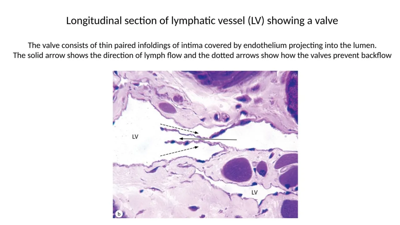 Lymphatic vessel in longitudinal section: valve of thin paired intimal folds prevents backflow