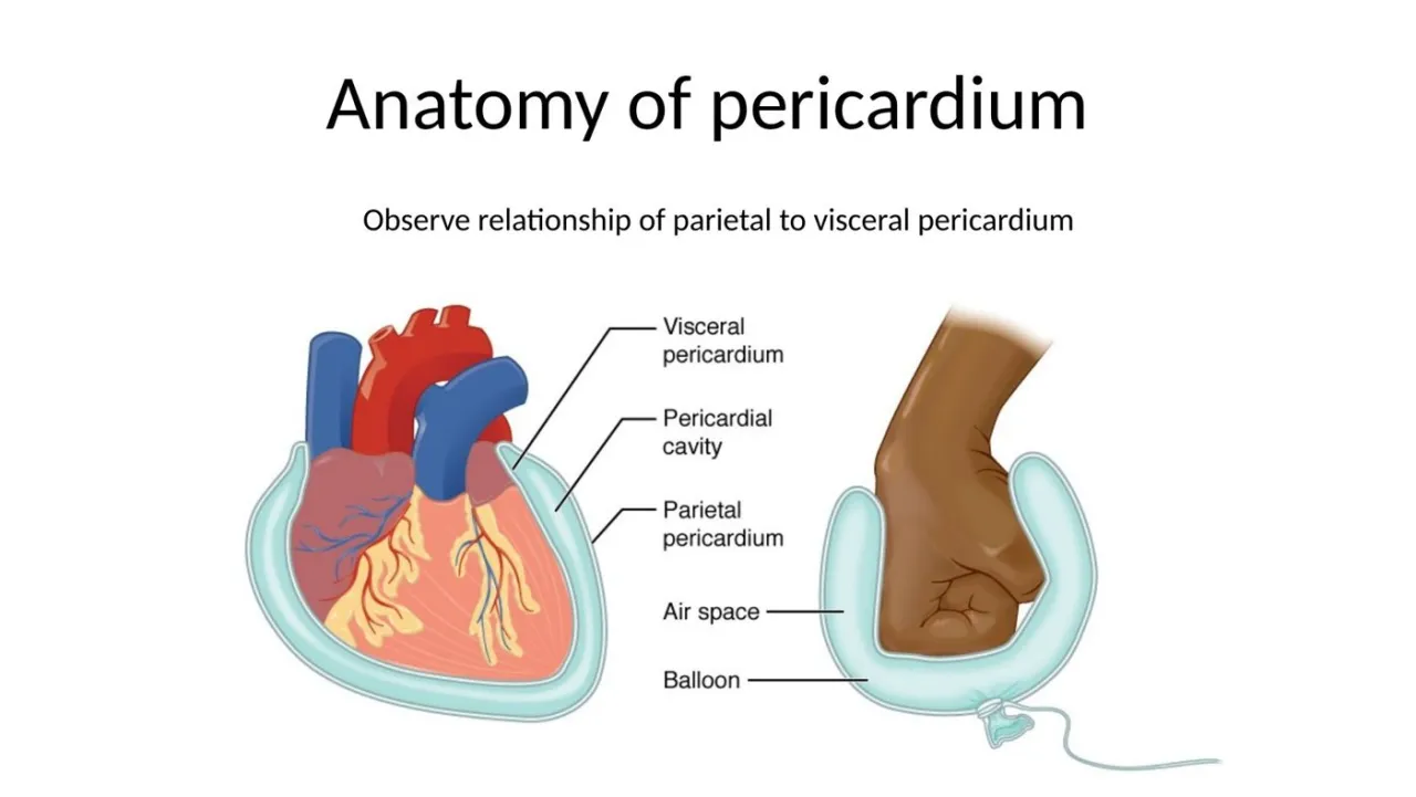 Balloon-and-fist diagram of visceral pericardium, pericardial cavity and parietal pericardium