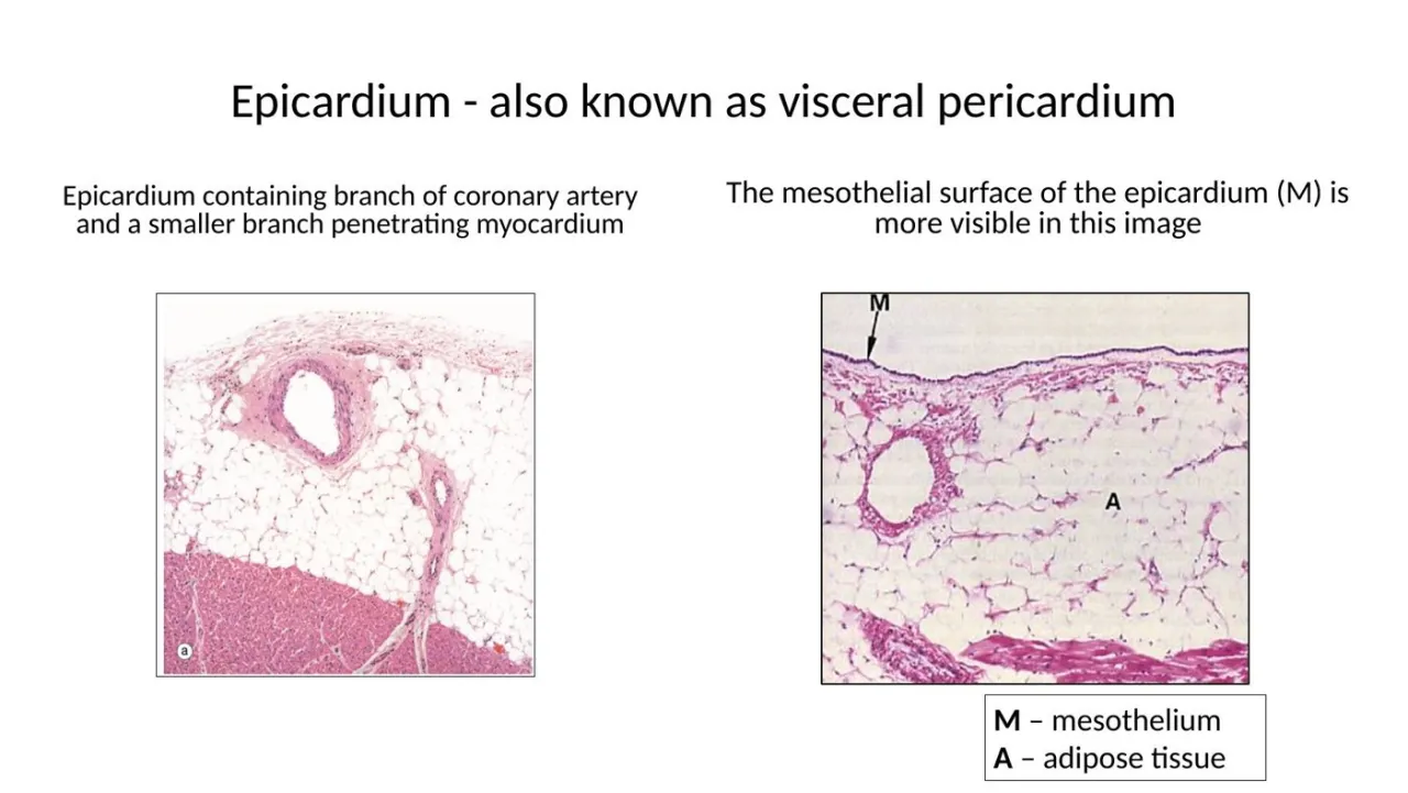 2026 lab: epicardium with coronary artery branch in fat; M = mesothelium, A = adipose
