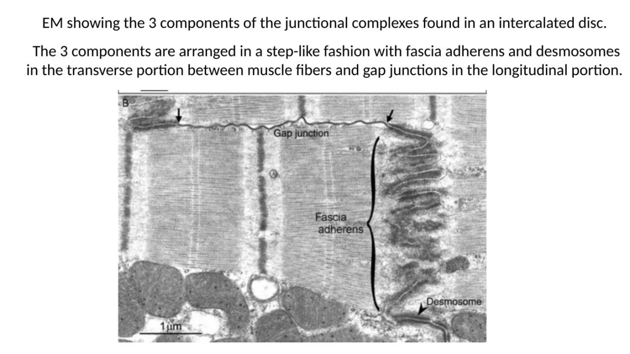 2026 session TEM: step-like disc, fascia adherens and desmosome transverse, gap junction lateral