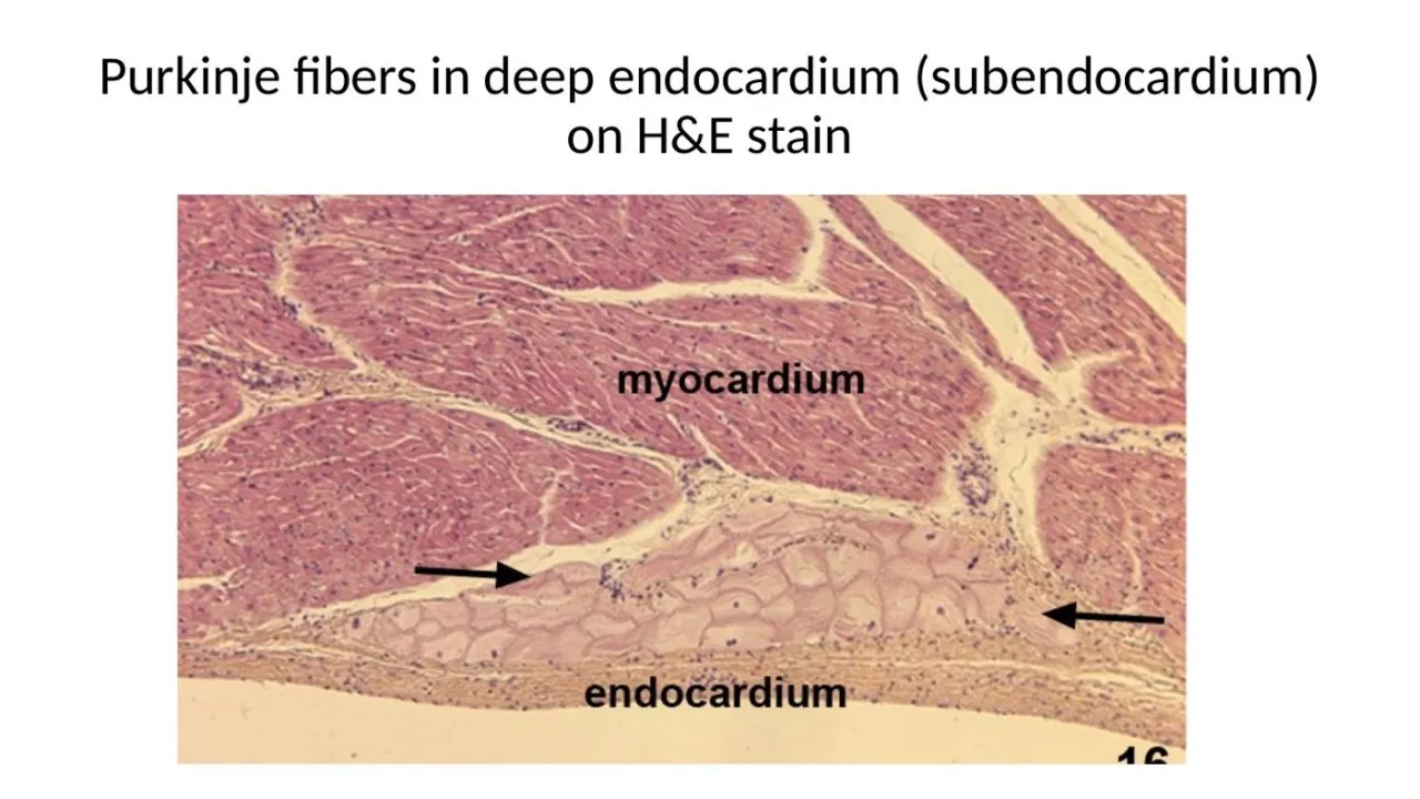 2026 session: Purkinje fibers in the deep endocardium (subendocardium) on H&E