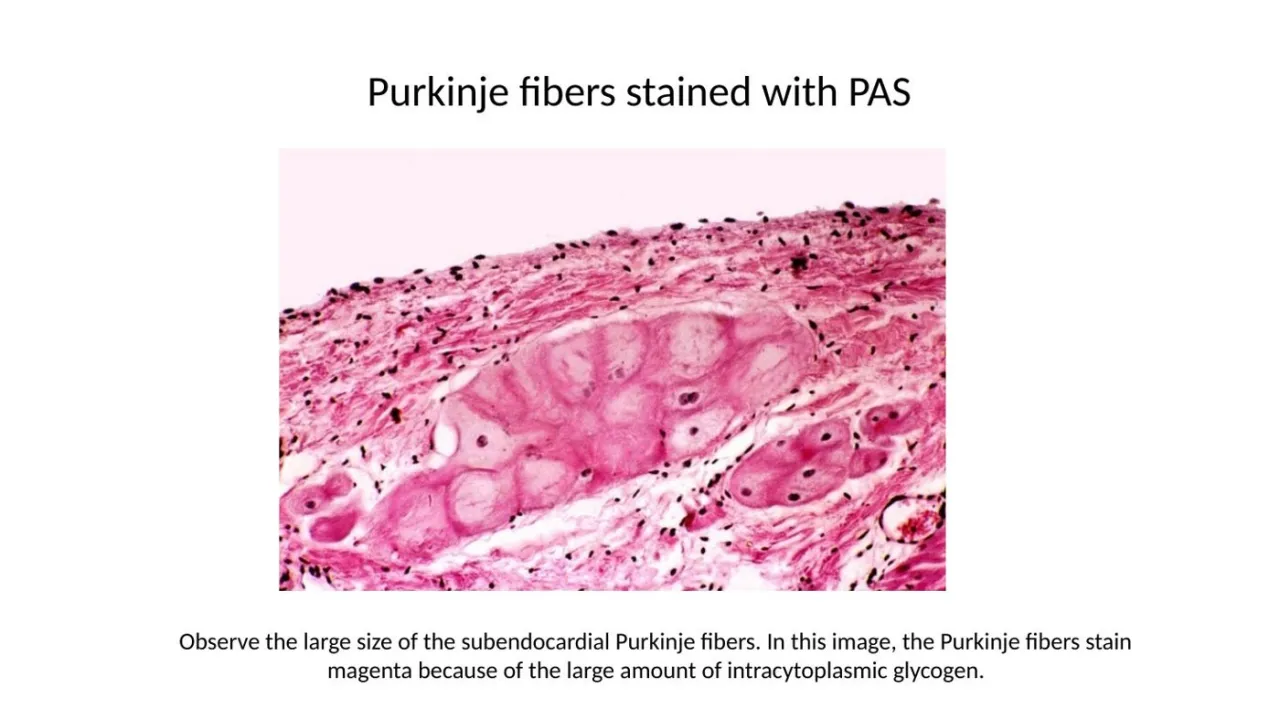 2026 session: PAS stains the glycogen-rich subendocardial Purkinje fibers magenta