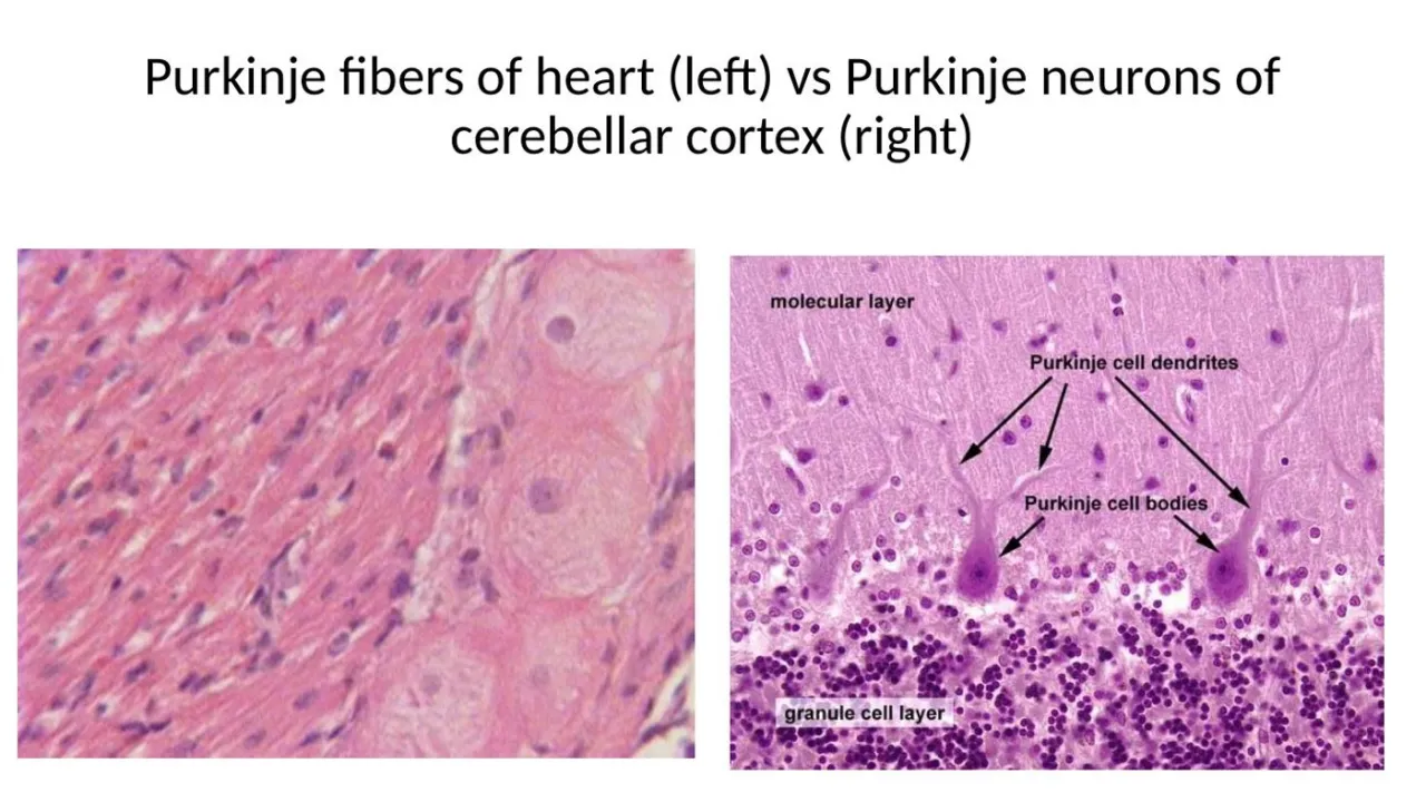 2026 session: cardiac Purkinje fibers vs cerebellar Purkinje neurons