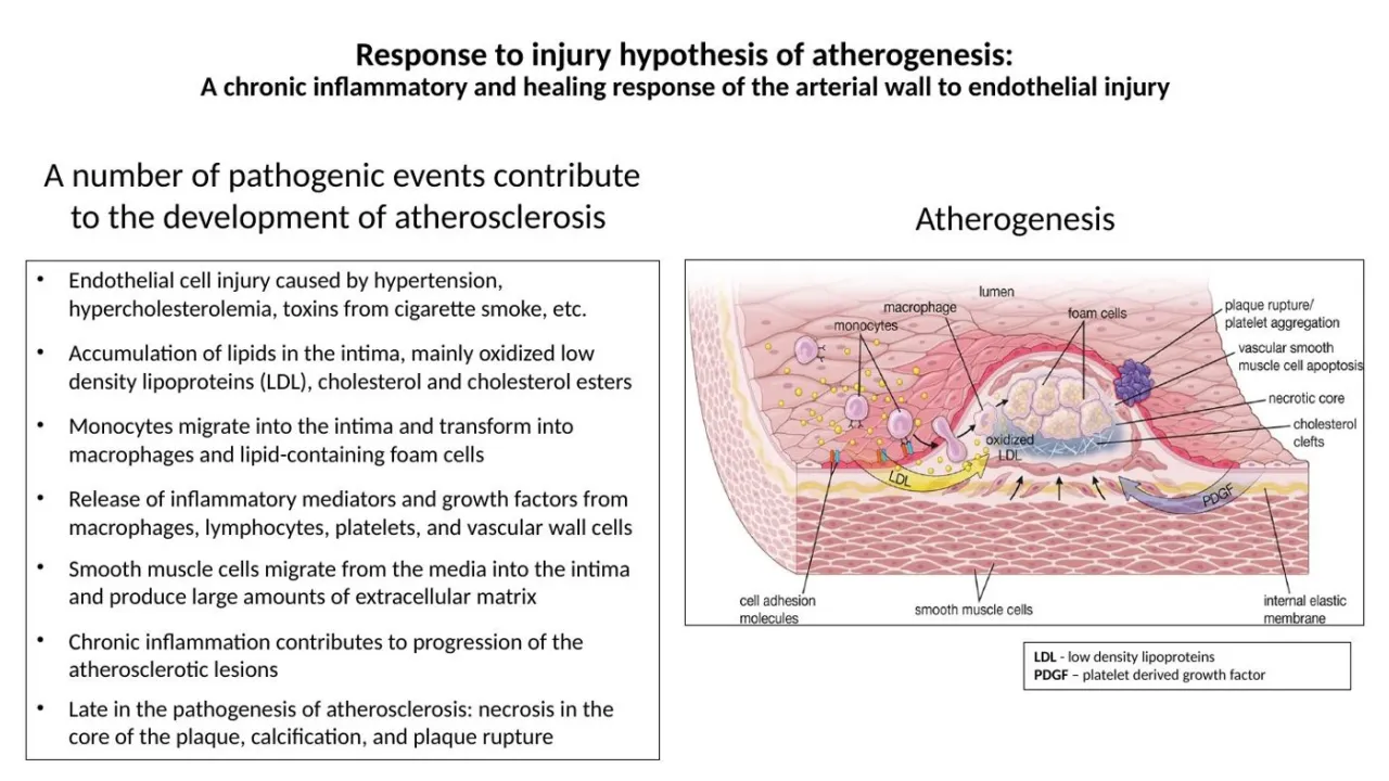 2026 session: response to injury: macrophages become foam cells; SM cells migrate and make matrix