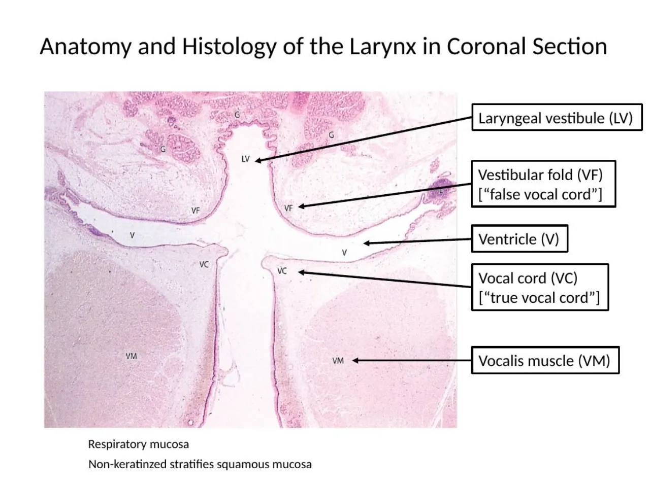 2026 lab: larynx coronal, vestibular fold, ventricle, vocal cord, vocalis; respiratory vs squamous mucosa