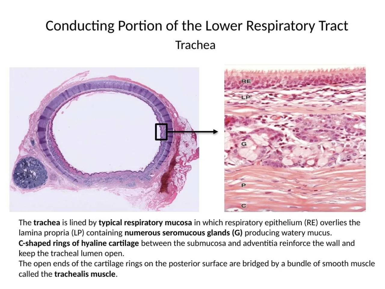 2026 lab: trachea, respiratory epithelium, lamina propria, seromucous glands, C-shaped hyaline ring
