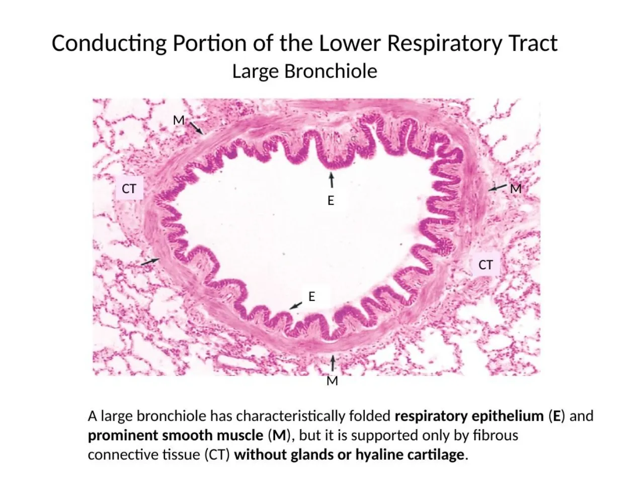 2026 lab: large bronchiole, folded epithelium (E), prominent smooth muscle (M), no glands or cartilage
