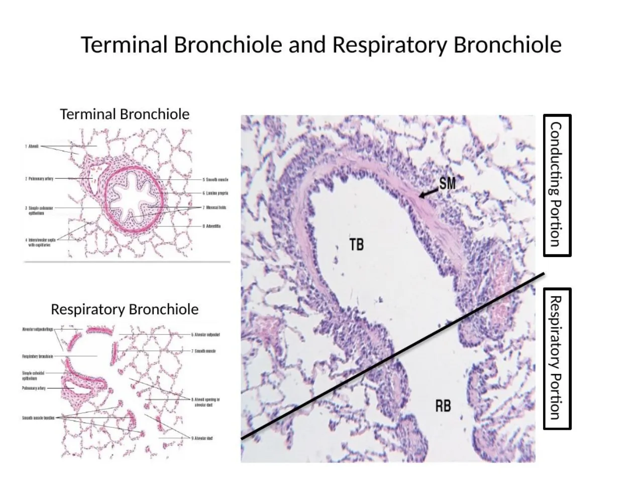 2026 lab: terminal bronchiole (conducting) opening into a respiratory bronchiole; the line marks the border