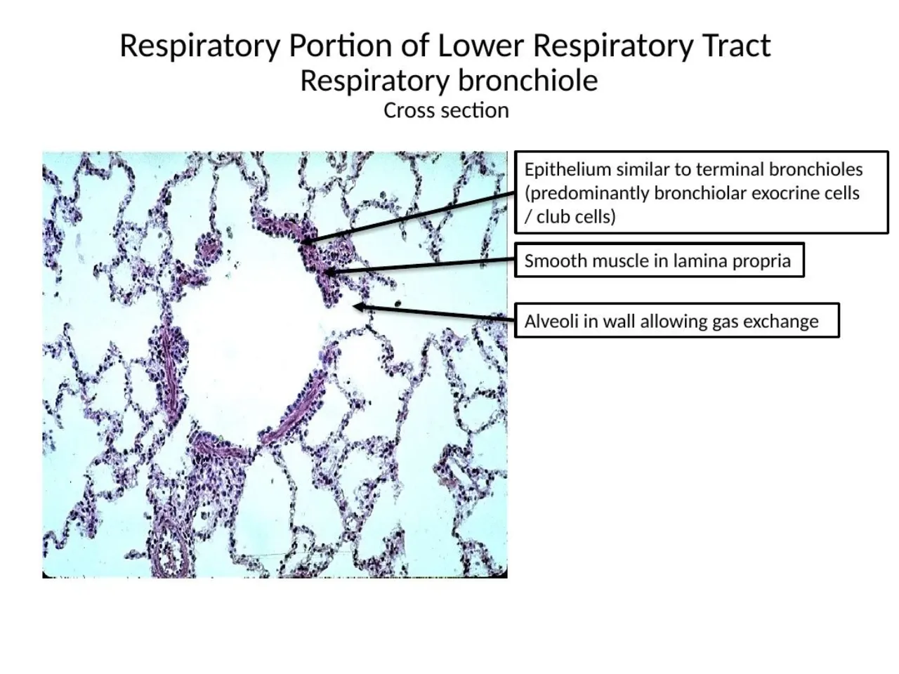 2026 lab: respiratory bronchiole cross section: club-cell epithelium, smooth muscle, alveoli in the wall