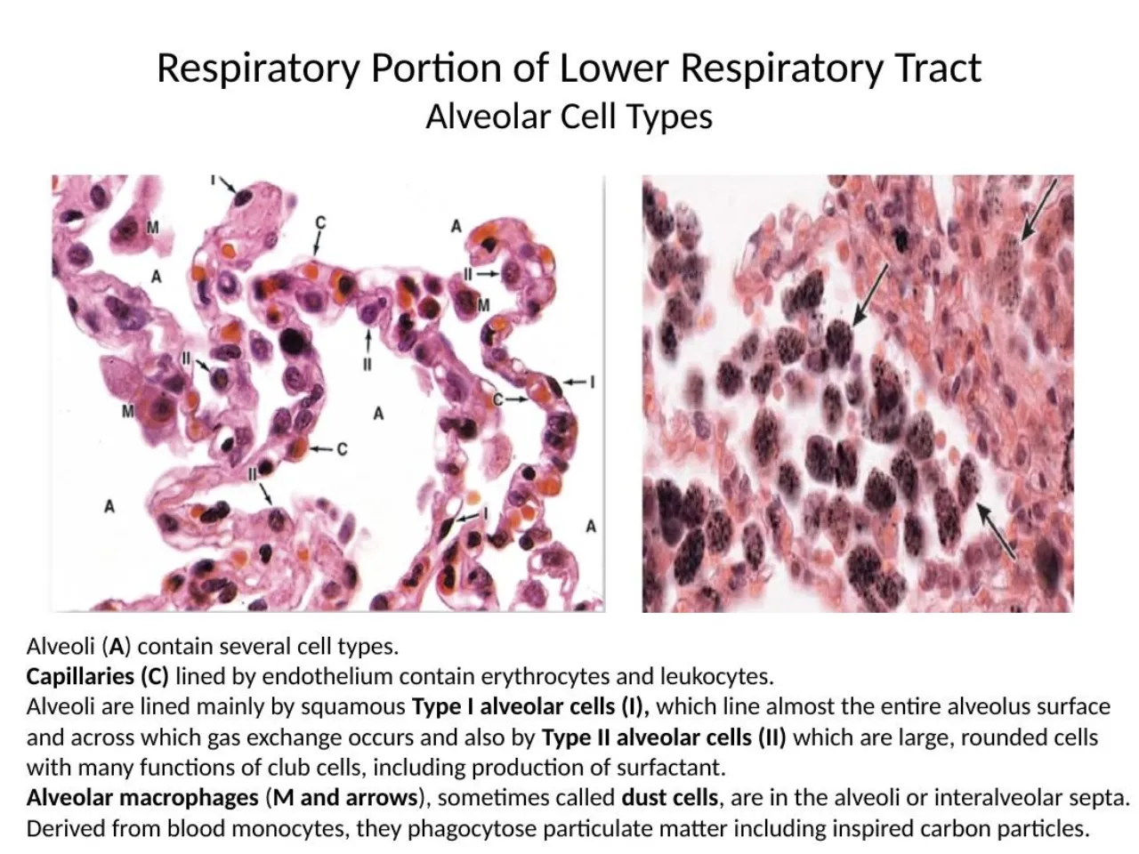 2026 lab: alveolar wall with type I, type II, capillaries, macrophages; carbon-laden dust cells