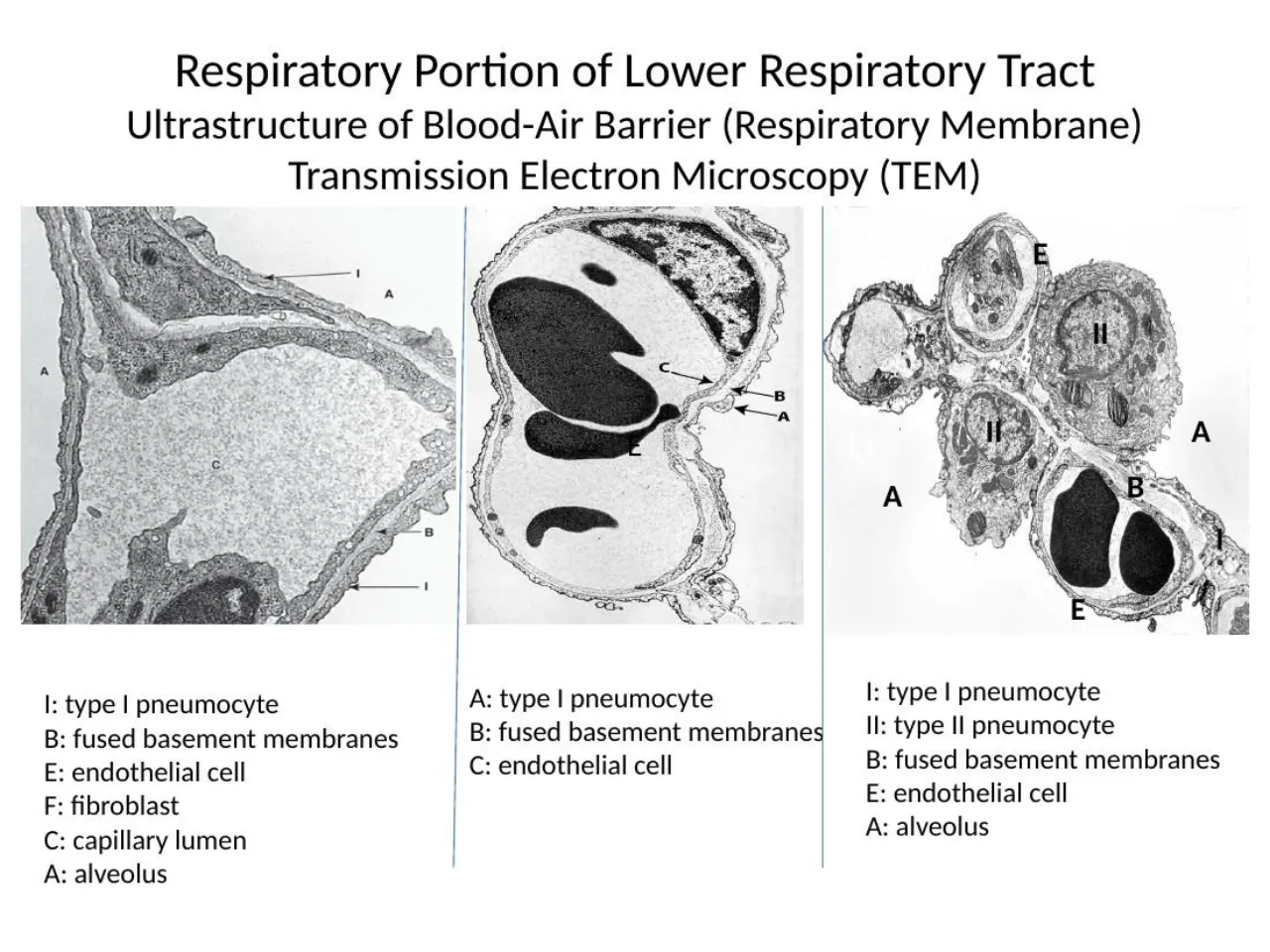 2026 lab TEMs: type I cell, fused basement membranes, endothelial cell, type II cells, fibroblast