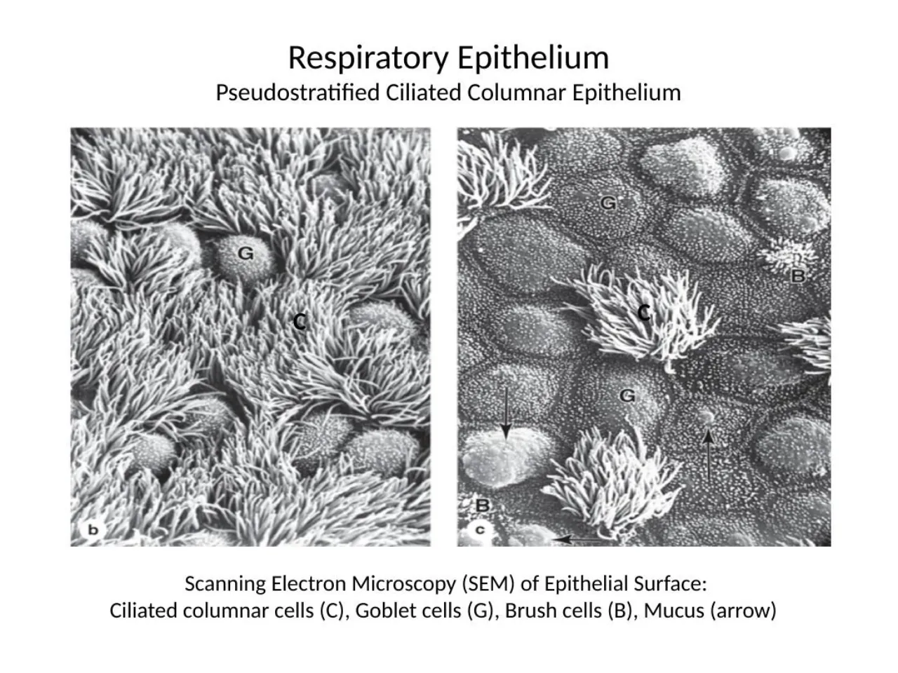 2026 lab: SEM of airway surface, ciliated cells (C), goblet cells (G), brush cells (B), mucus