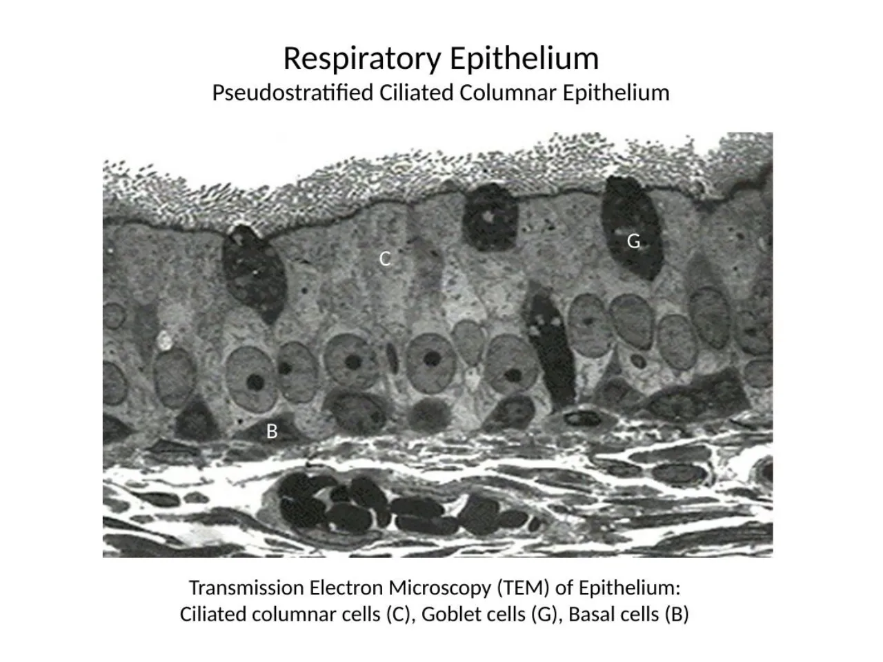 2026 lab: TEM of respiratory epithelium, ciliated (C), goblet (G) and basal (B) cells
