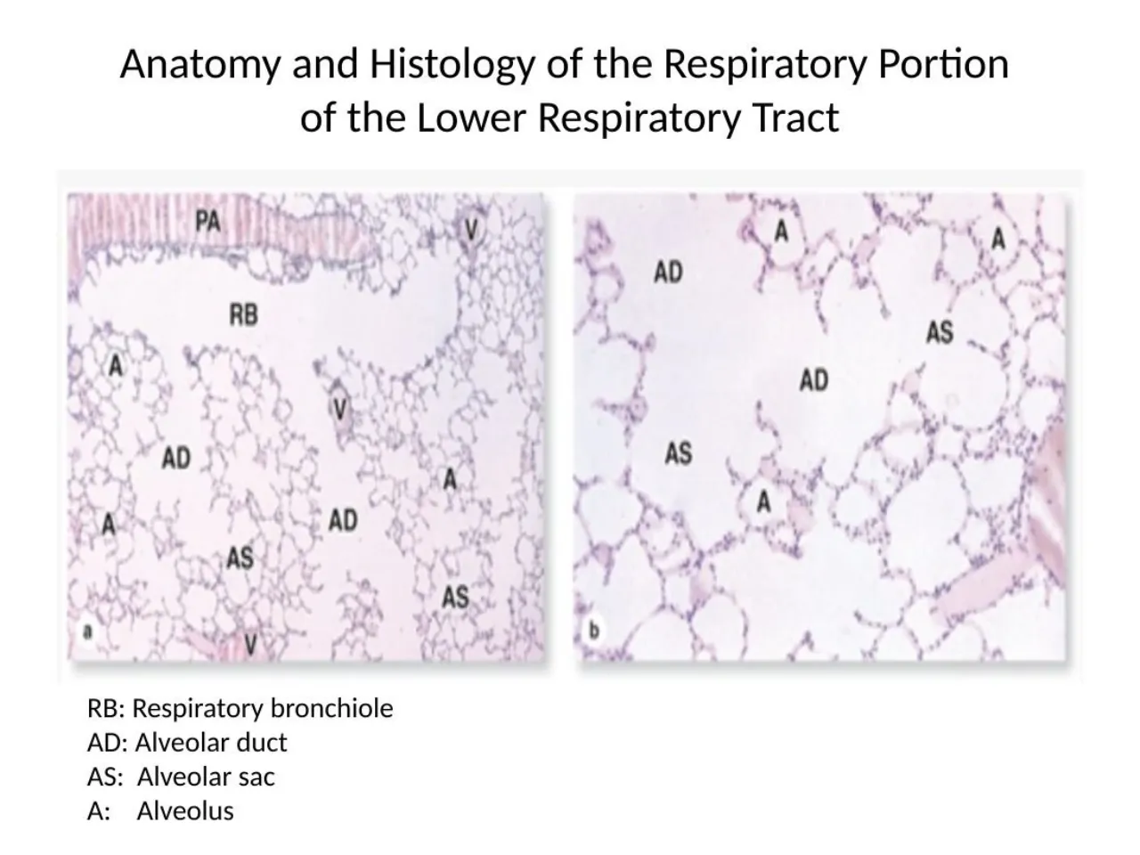 2026 interactive session: respiratory bronchiole, alveolar ducts, alveolar sacs and alveoli labelled