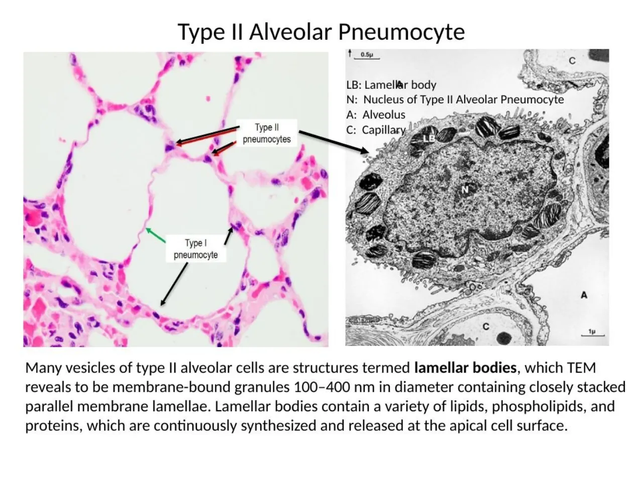 2026 session: type II cells (red arrows) vs type I (green arrow); TEM of a type II cell with lamellar bodies
