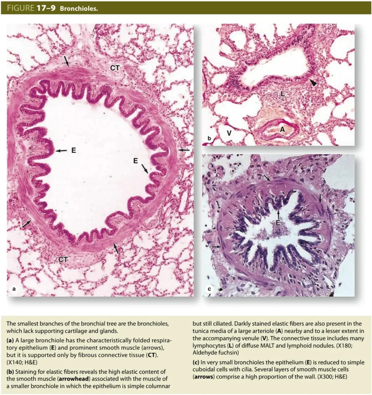 Junqueira Fig 17-9: bronchioles, folded epithelium and prominent smooth muscle, no cartilage or glands